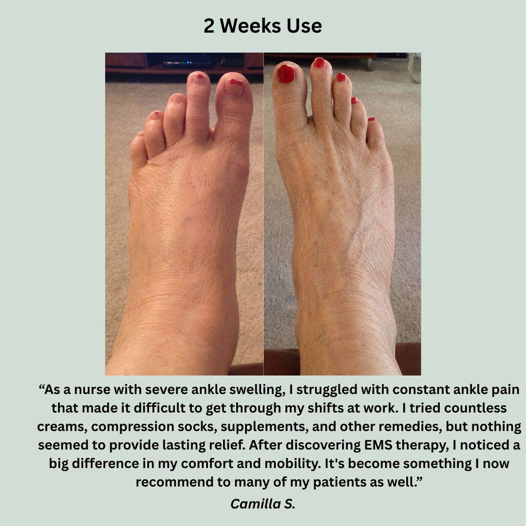 NUV Ankle Edema Wrap - Say Goodbye To Swollen Ankles