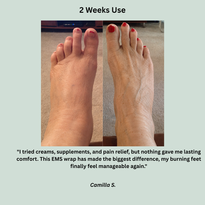 NUV Neuropathy Ankle Wrap - Say goodbye to burning feet