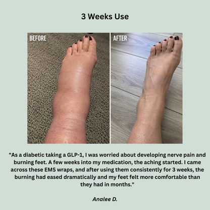 NUV Neuropathy Ankle Wrap - Say goodbye to burning feet